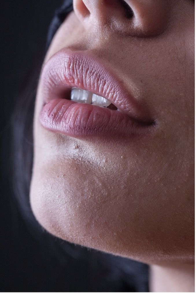 Cuidado de la piel alrededor de los labios: Claves para una sonrisa radiante | Centro odontológico y formativo
