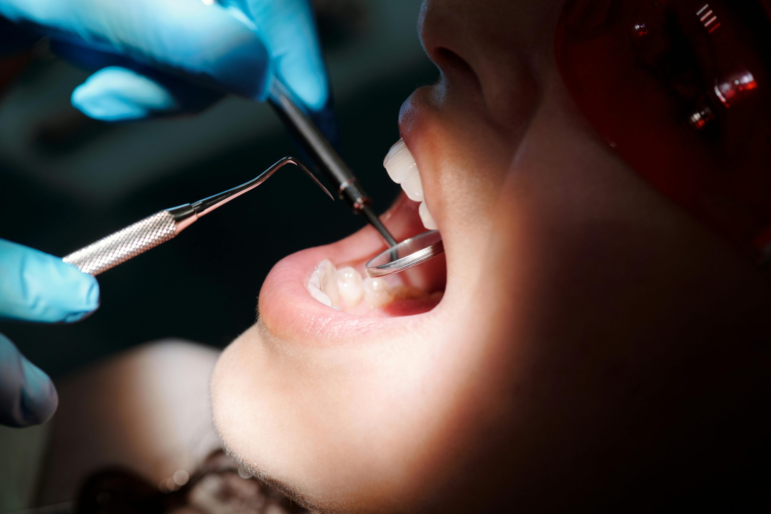 L’elecció perfecta per a un somriure radiant: Descobreix el material ideal per als teus empastaments | Centre odontològic i formatiu