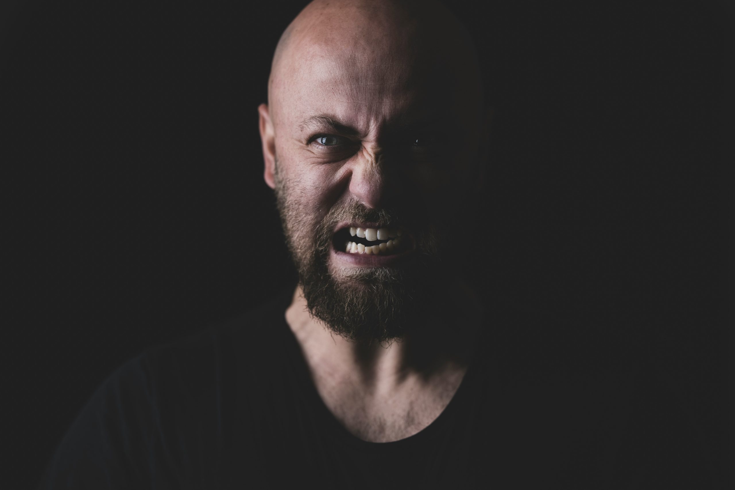Aprieto los dientes ¿es bruxismo? ¿Cuál es su tratamiento? ¿Puede la odontología preventiva aliviar el bruxismo? | Centro odontológico y formativo
