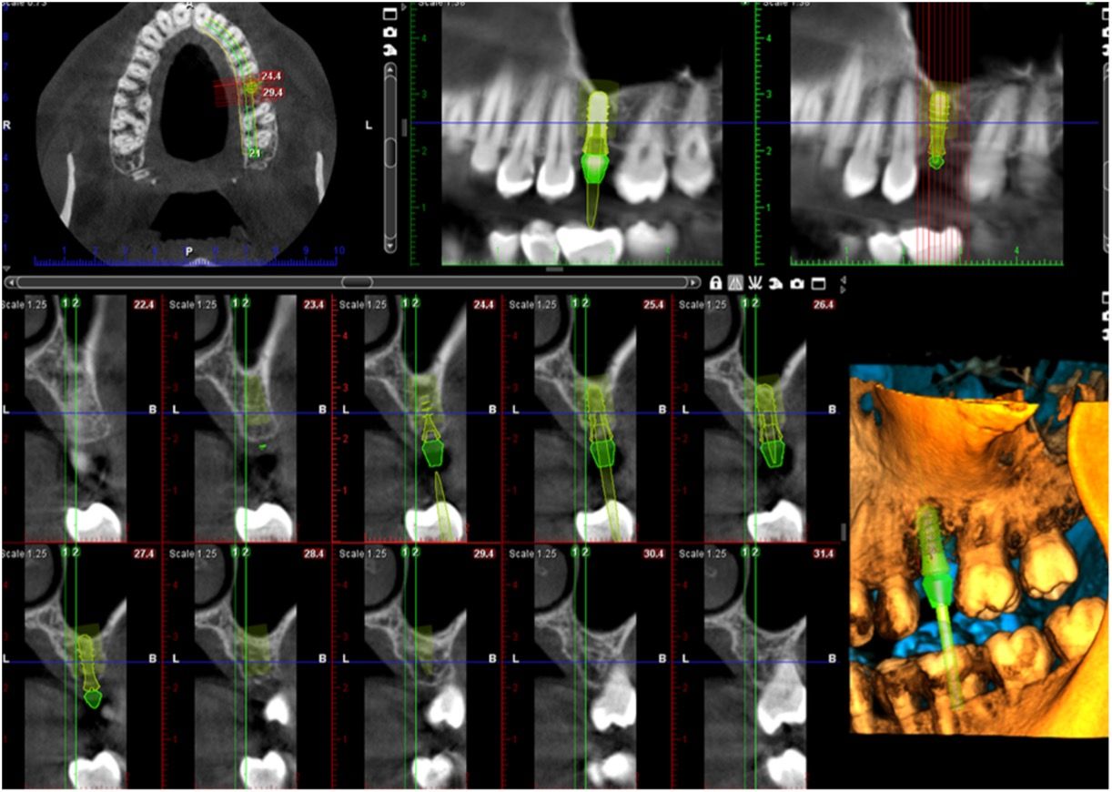 Evolución de la odontología digital: Innovación para sonrisas saludables | Centro odontológico y formativo